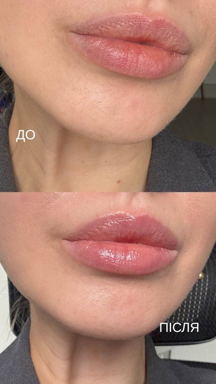 Глянцевый бальзам глубокого увлажнения Utsukusy Plump Lip Gloss , 10ml