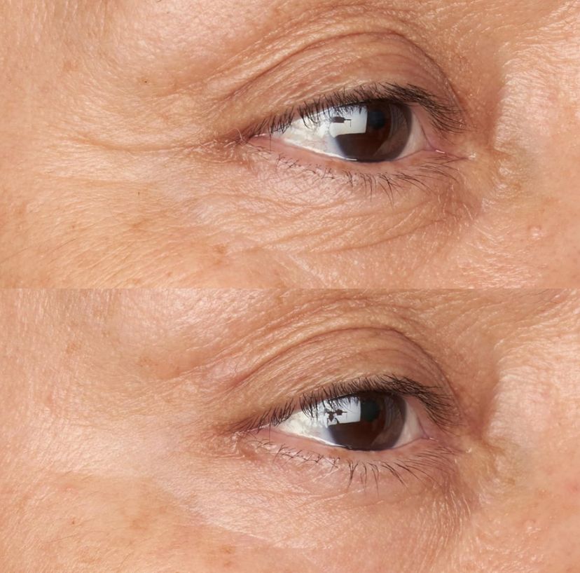Зволожуючий і освітлюючий крем для зони навколо очей Hypoallergenic Clean Firming&Brightening Eye, 15мл