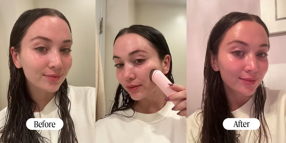 Пристрій для домашнього догляду за шкірою 6 в 1 MEDICUBE AGE-R Booster Pro, Pink