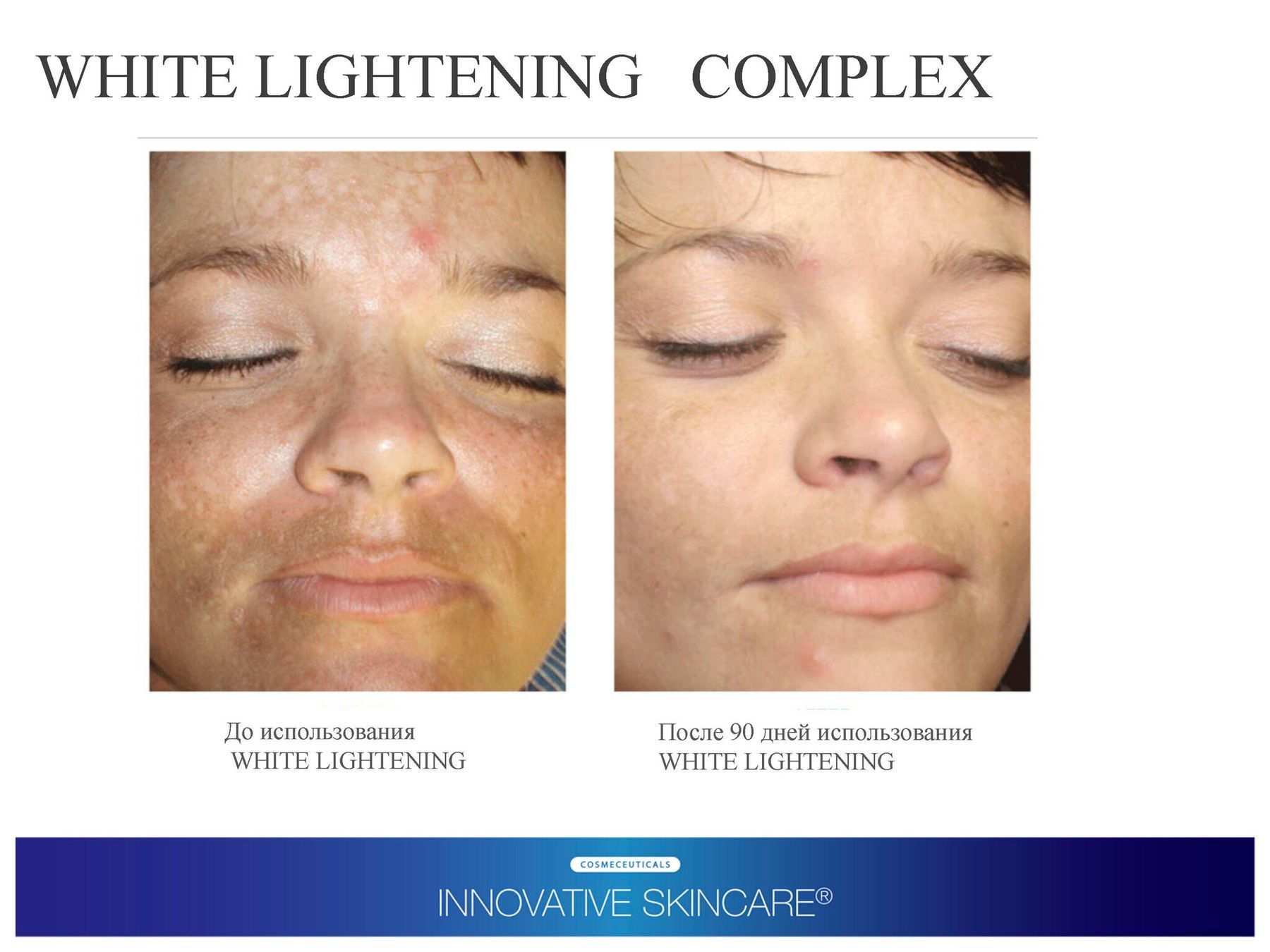 Осветляющая сыворотка Brightening Serum iS Clinical, 15мл