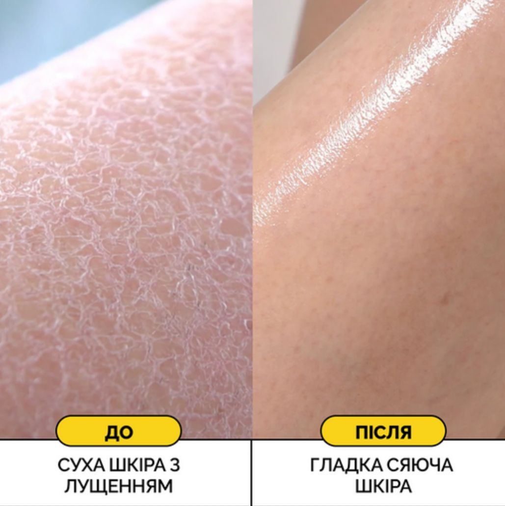 Противовоспалительный гель для душа с кислотами Medicube Red Acne Body Wash, 400мл