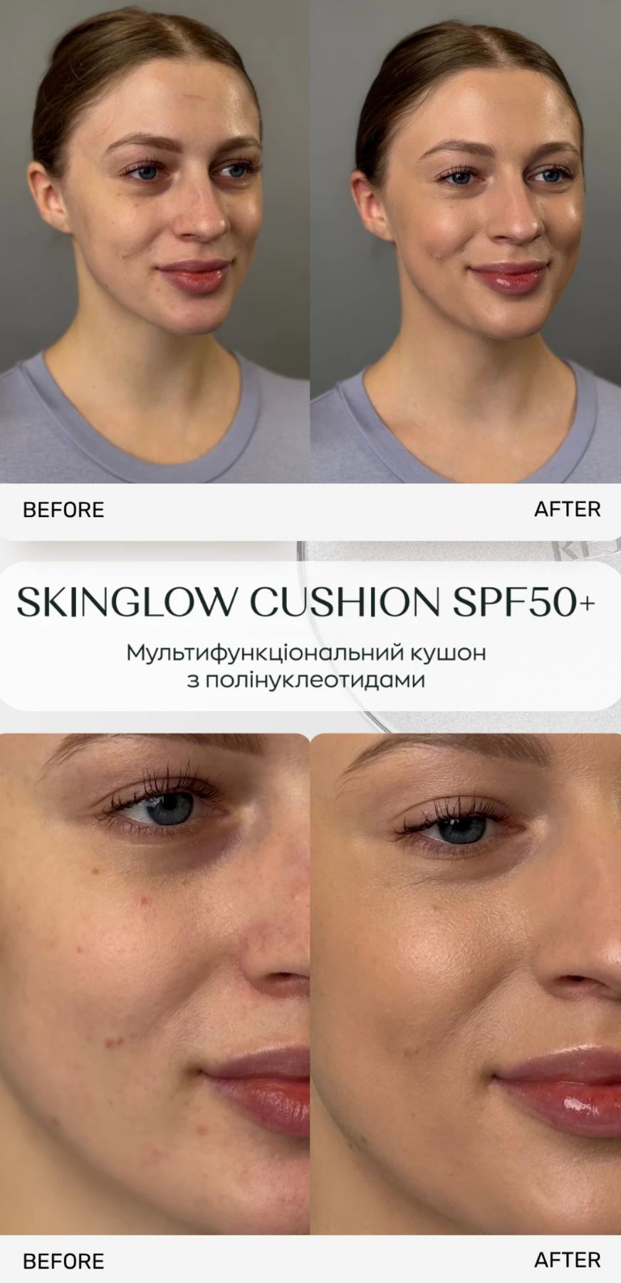 Мультифункциональный кушон с полинуклеотидами Skinglow Cushion SPF50+ Rejuran, 15g