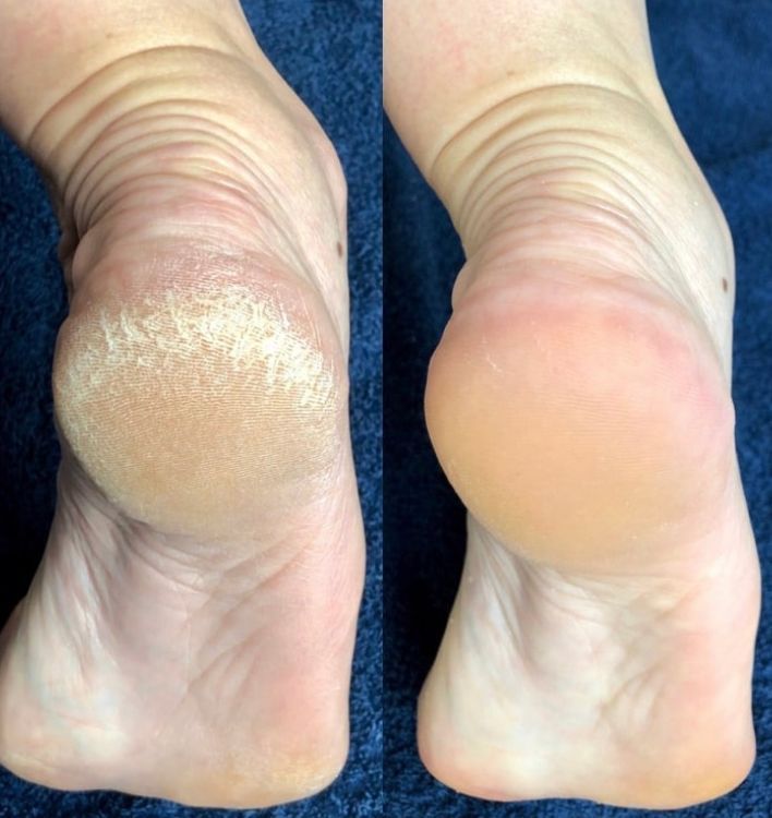 Миттєвий спрей для догляду за ногами Spray Instant Foot Peeling, 100мл